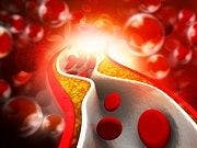 PCSK9 Eligibility Concerns Highlight AJPB Week in Review