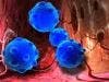 Immune Checkpoint Inhibitors More Effective in Men Than Women for Advanced Cancers