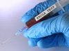 The 3 Drug Classes for Experimental Ebola Treatment