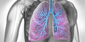 COPD Linked with Increased Risk of Cognitive Impairment