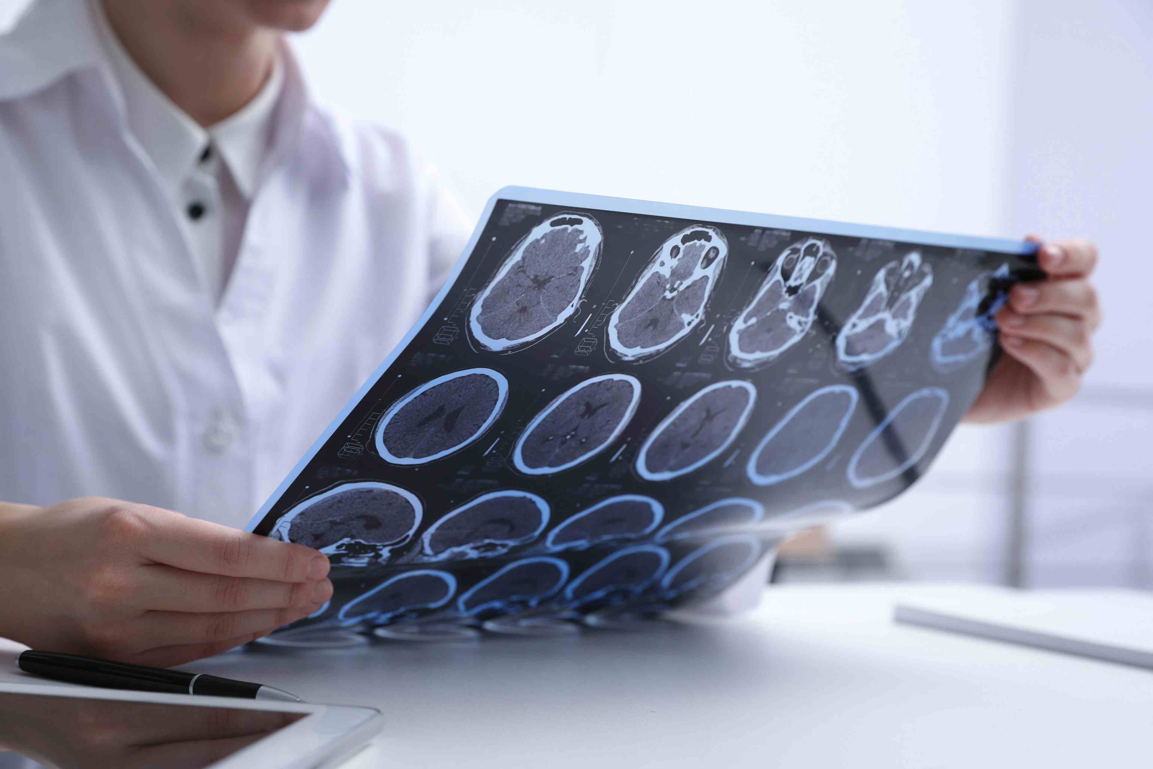 Health care provider examining MRI images of patient with multiple sclerosis -- Image credit: New Africa | stock.adobe.com