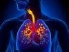 Groundbreaking Lung Cancer Test Detects Disease in Early Stage