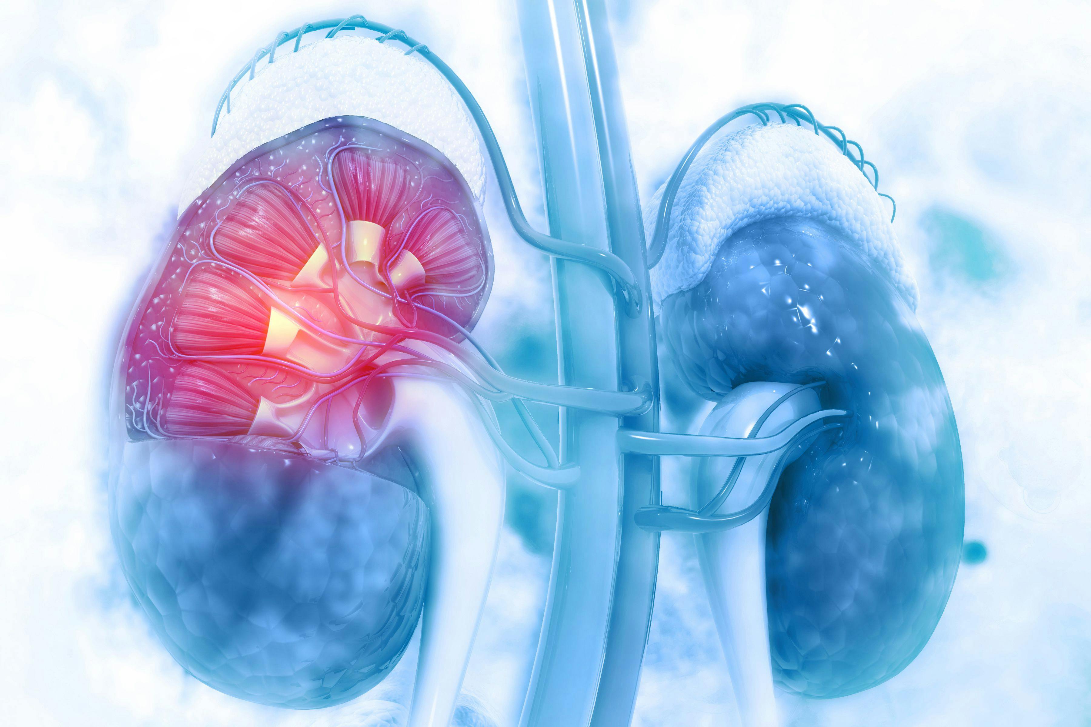SPS Associated with Higher Risk of GI Complications in Patients with Chronic Kidney Disease
