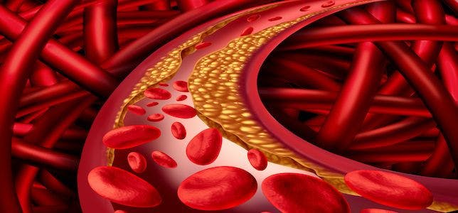 Study: Nanodroplets, Ultrasound ‘Drills’ Effectively Break Up Blood Clots
