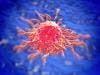 Cabozantinib Improves Survival in Advanced Hepatocellular Carcinoma