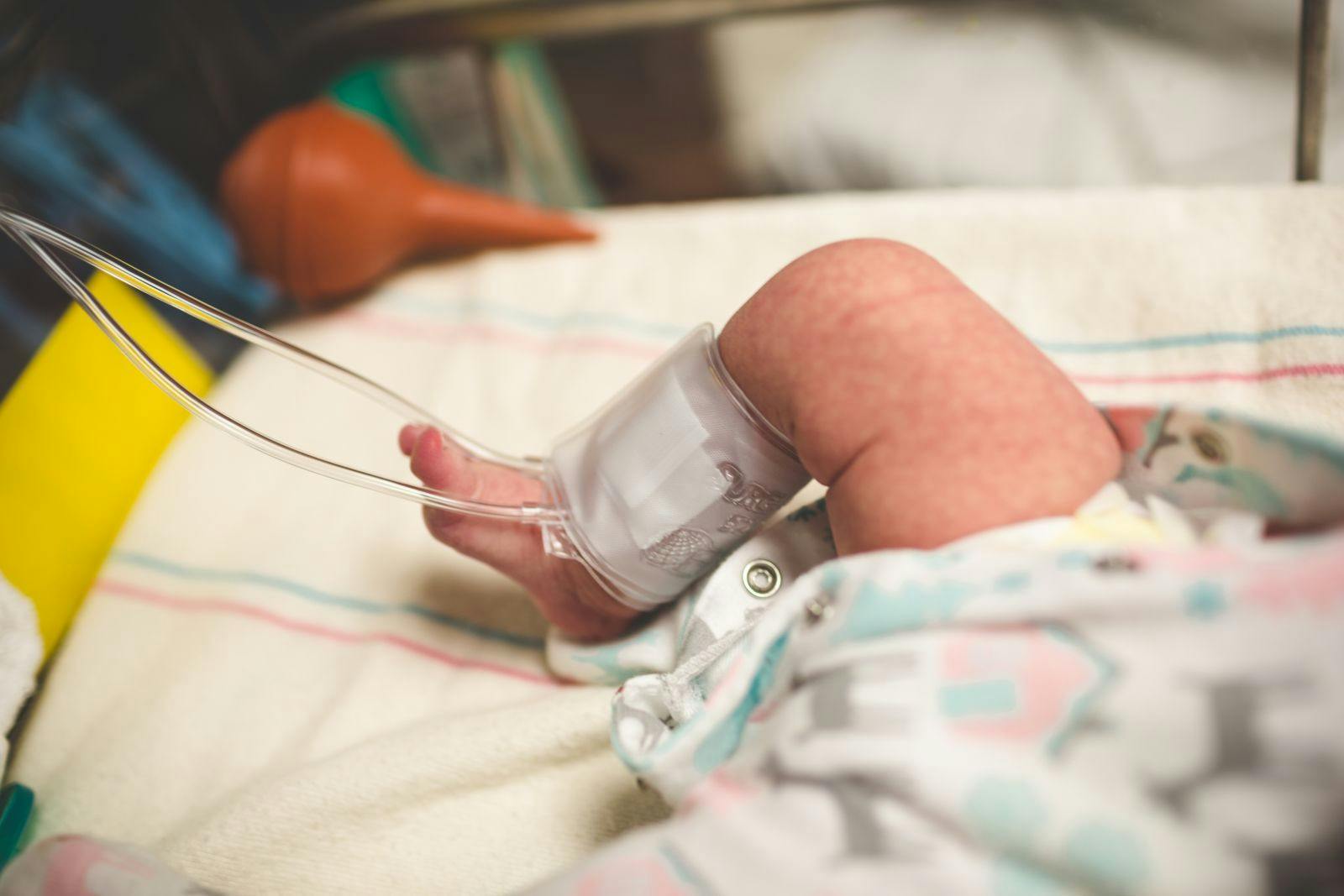 Phase 4 Nusinersen Trial Underway in Infants, Children With Spinal Muscular Atrophy