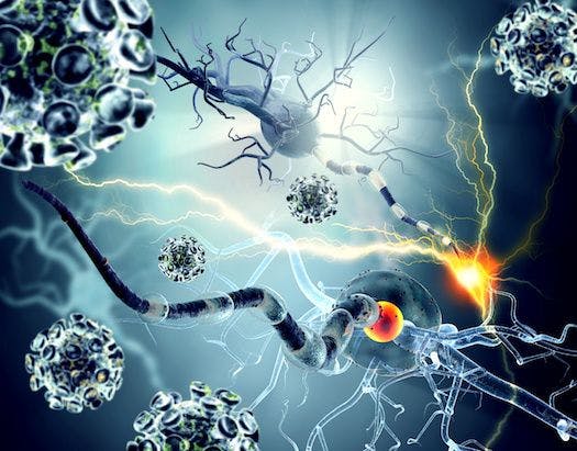 TG Therapeutics’ Ublituximab Shows Reduced Risk of Relapsing Forms of Multiple Sclerosis