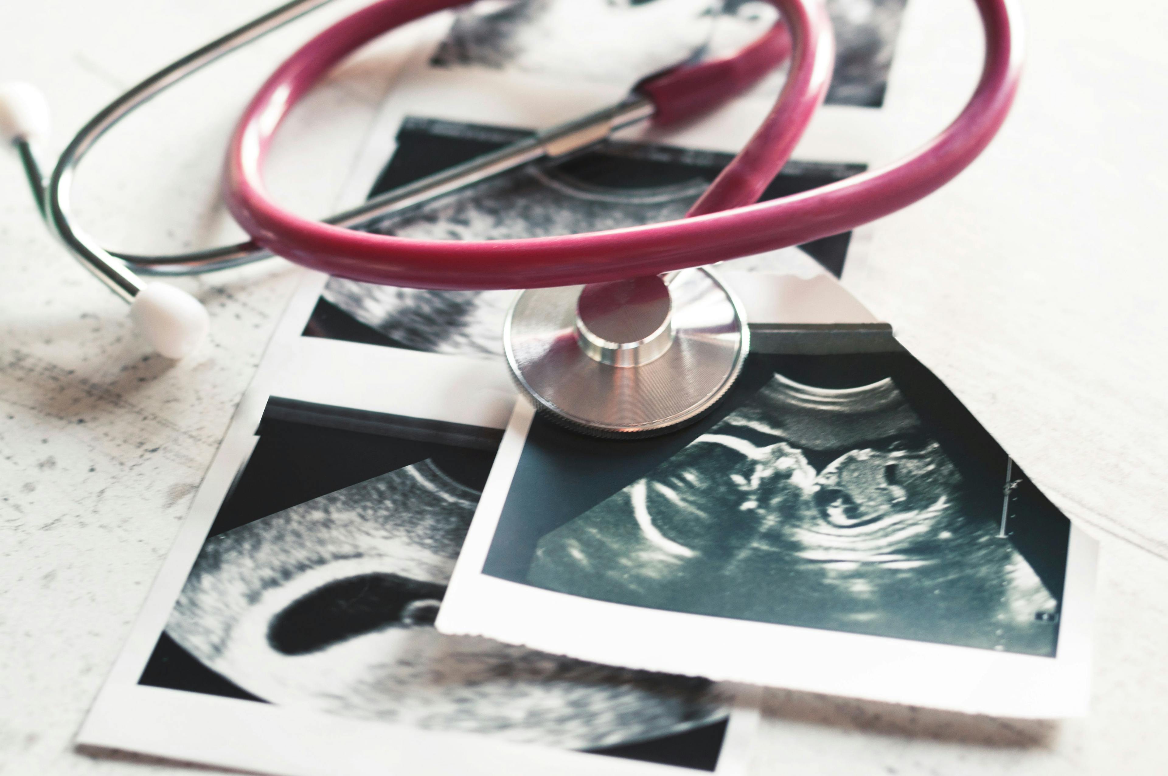 In the pictures of the ultrasound 4 weeks of pregnancy and 20 weeks is a phonendoscope. The concept of the study of pregnancy. Observation Selective focus - Image credit: Natalya Lys | stock.adobe.com 