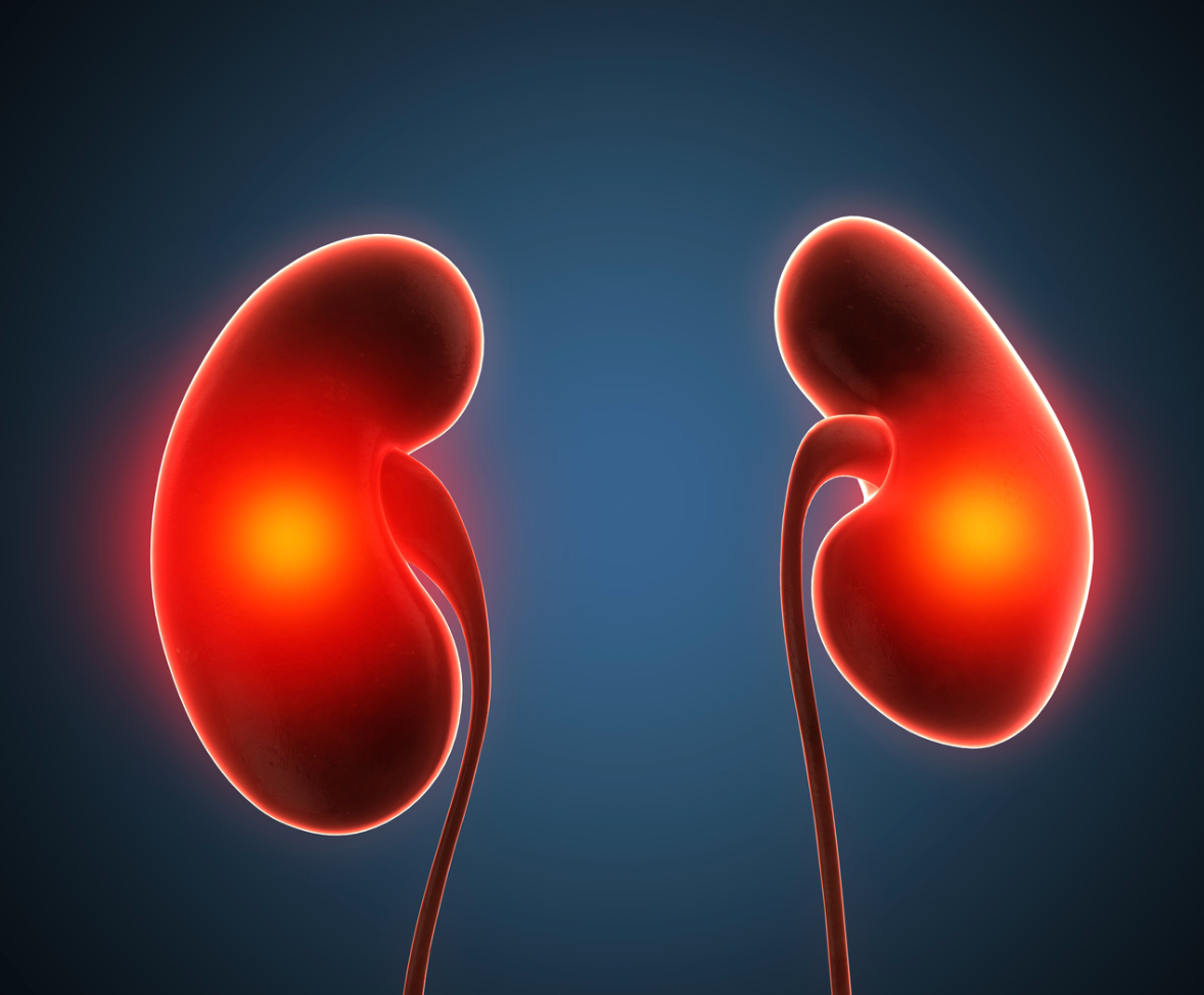 Treatment With Atrasentan Improves Albuminuria in Patients With Chronic Kidney Disease, Diabetes