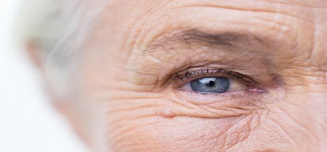OTC Focus Case Studies: Eye Problems