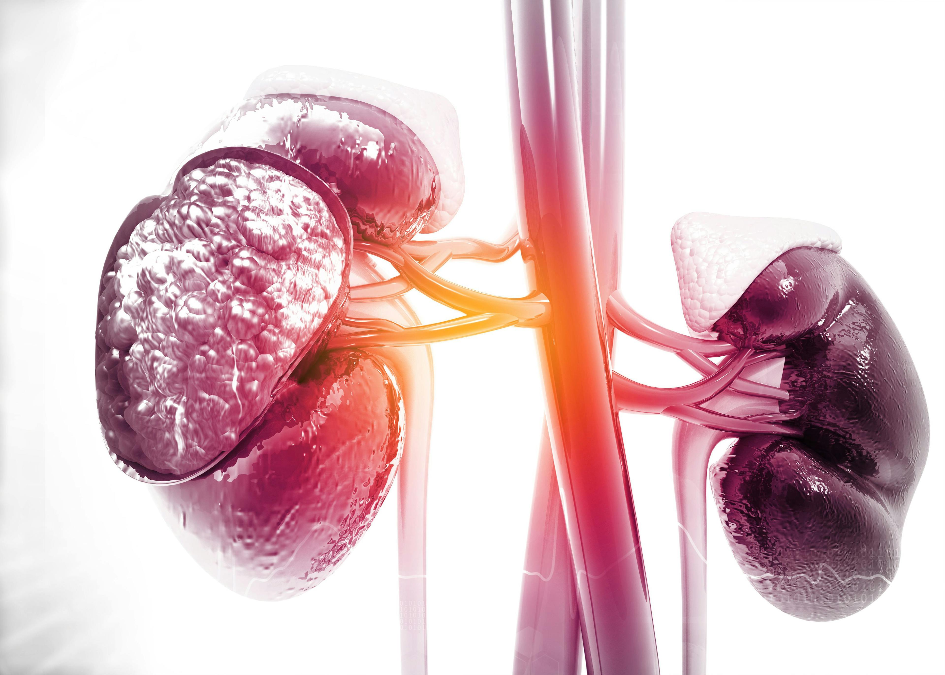Diseased human kidney on science background. 3d illustration | Image Credit: Rasi - stock.adobe.com