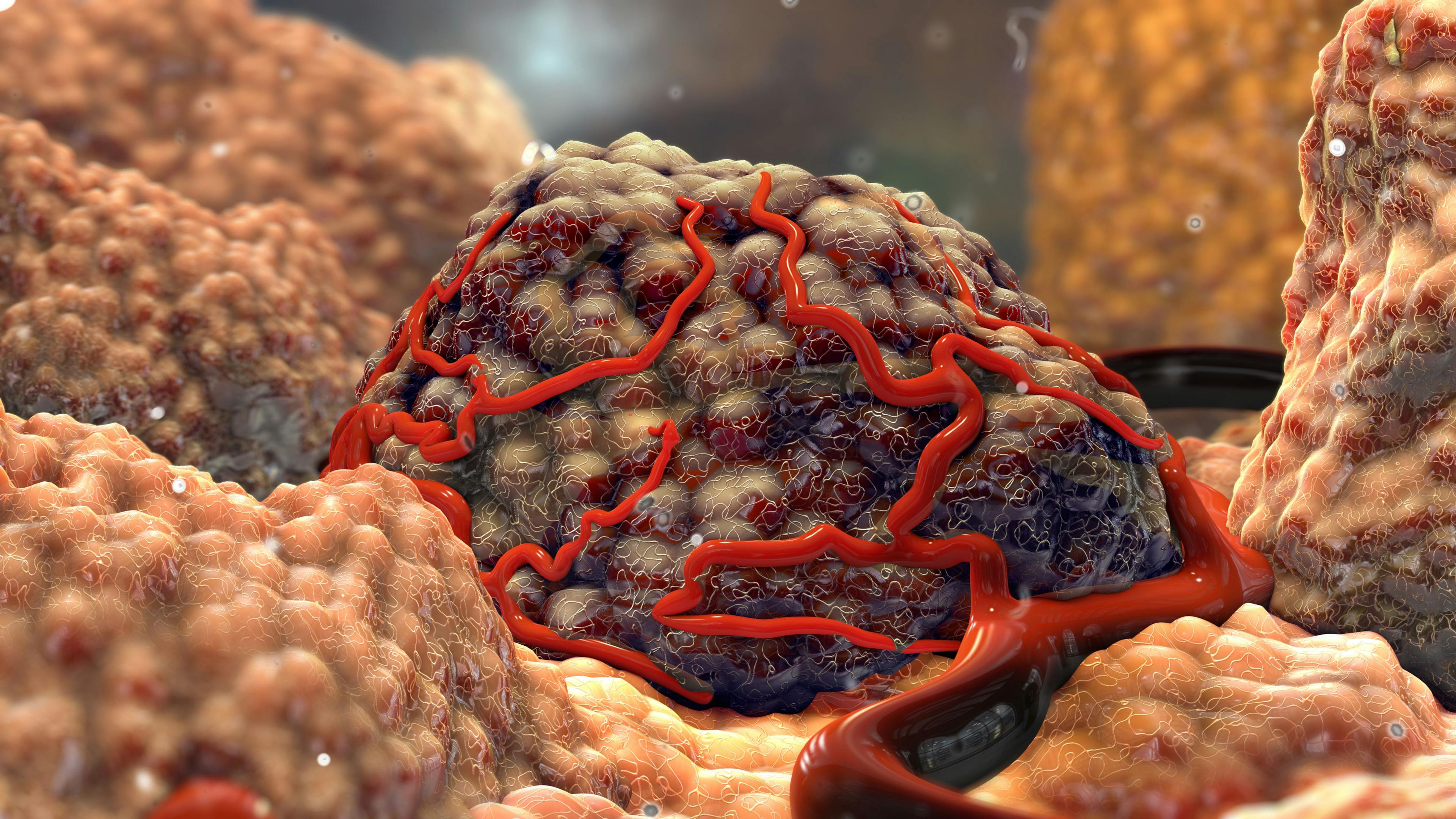 3D Tumor Cancer Cells