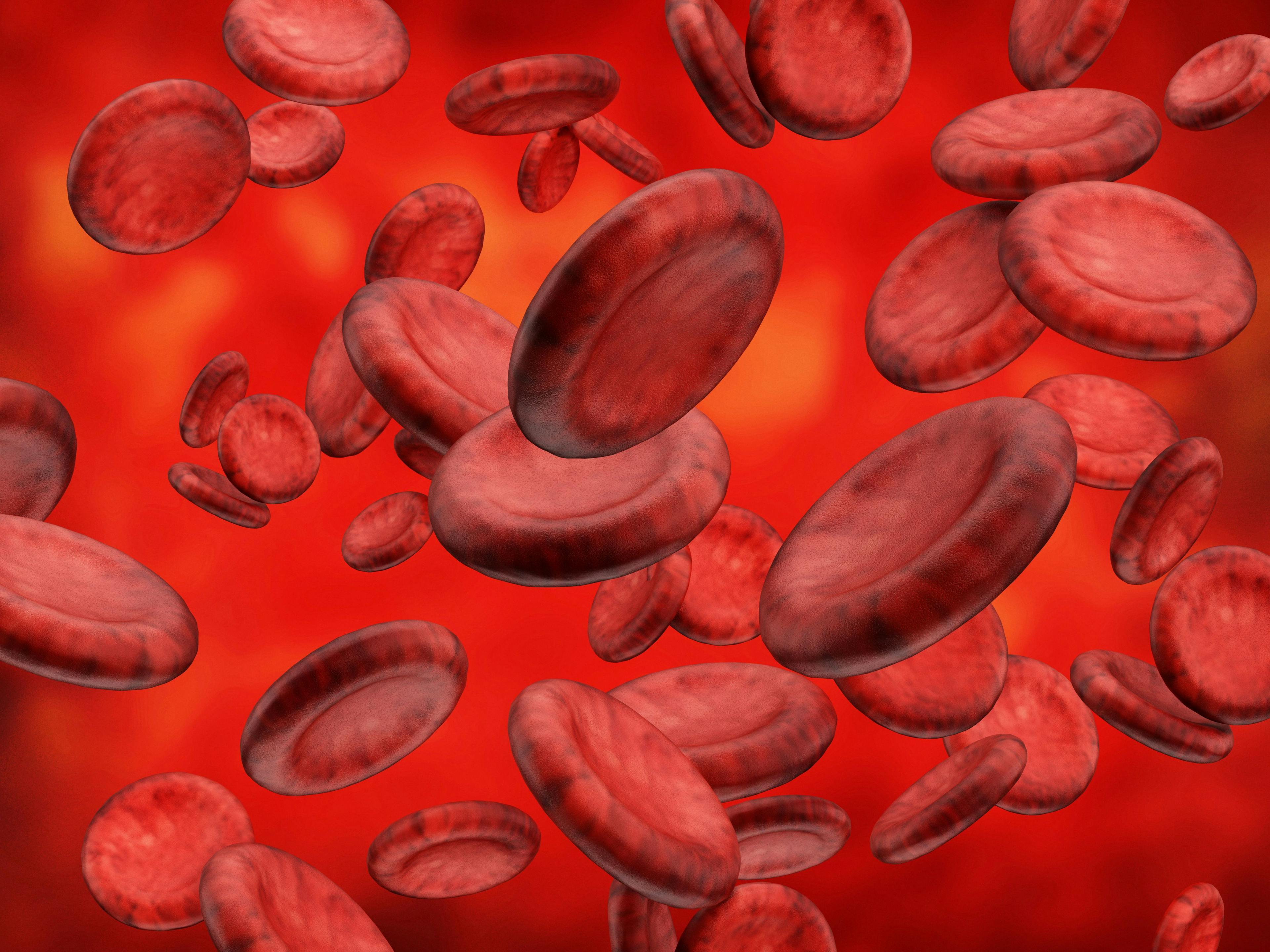 Novartis’ Iptacopan Meets 2 Endpoints for Paroxysmal Nocturnal Hemoglobinuria Treatment