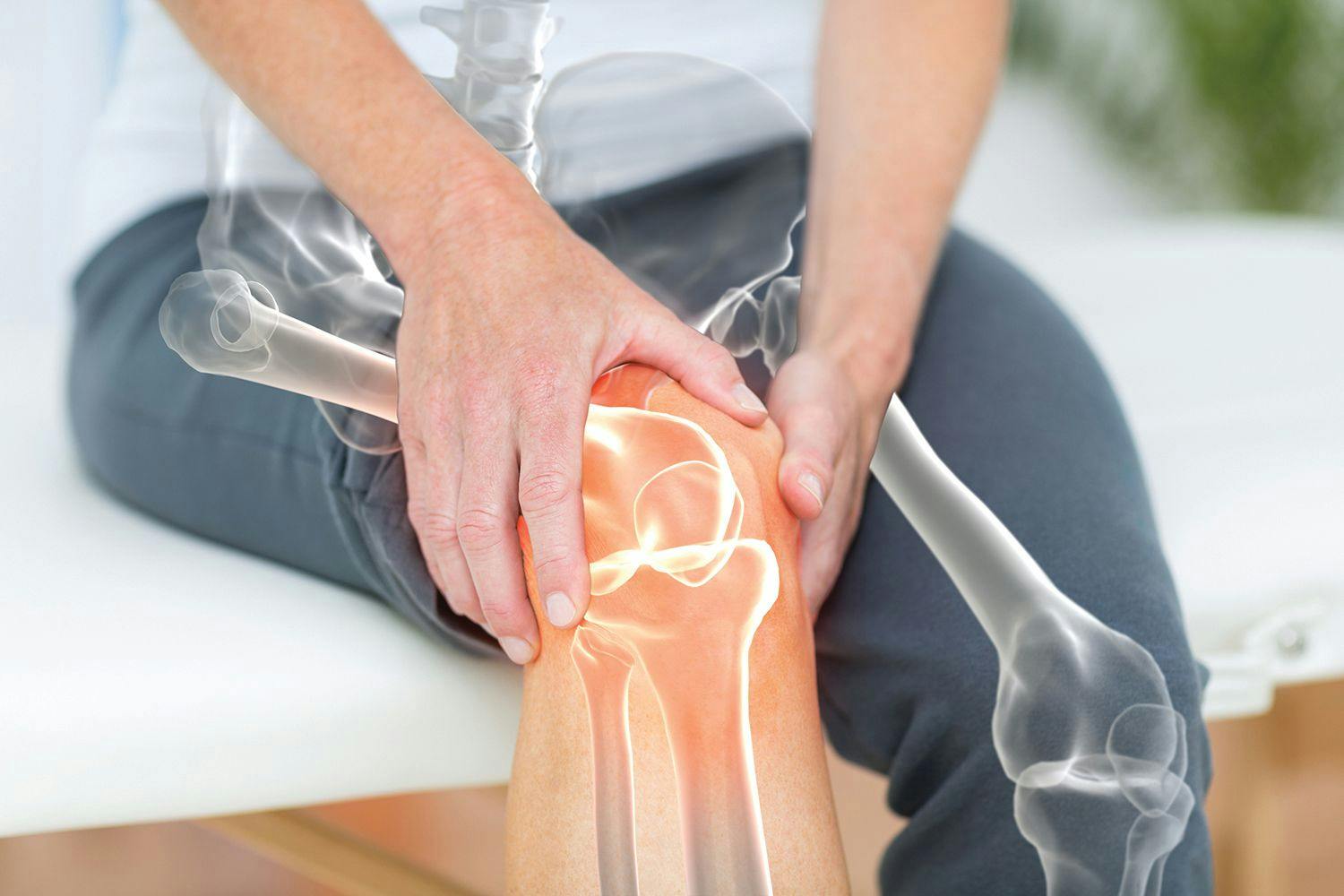 Trending News Today: Biologics Associated with Better Bone Density, Function in Psoriatic Arthritis