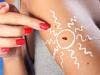 Melanomas More Likely to Arise From New Growths Than Existing Moles