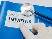 Eliminating Hepatitis B and C in the United States