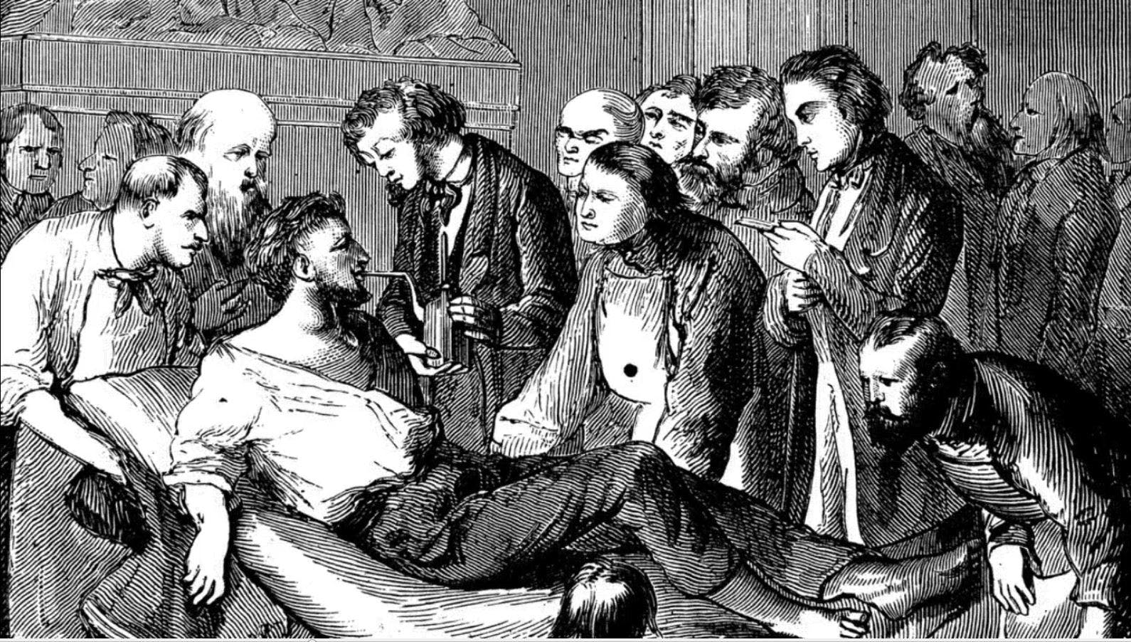 Pharmacy Fact: Before Modern Anesthesia, Knocking People Unconscious Was Hit Or Miss
