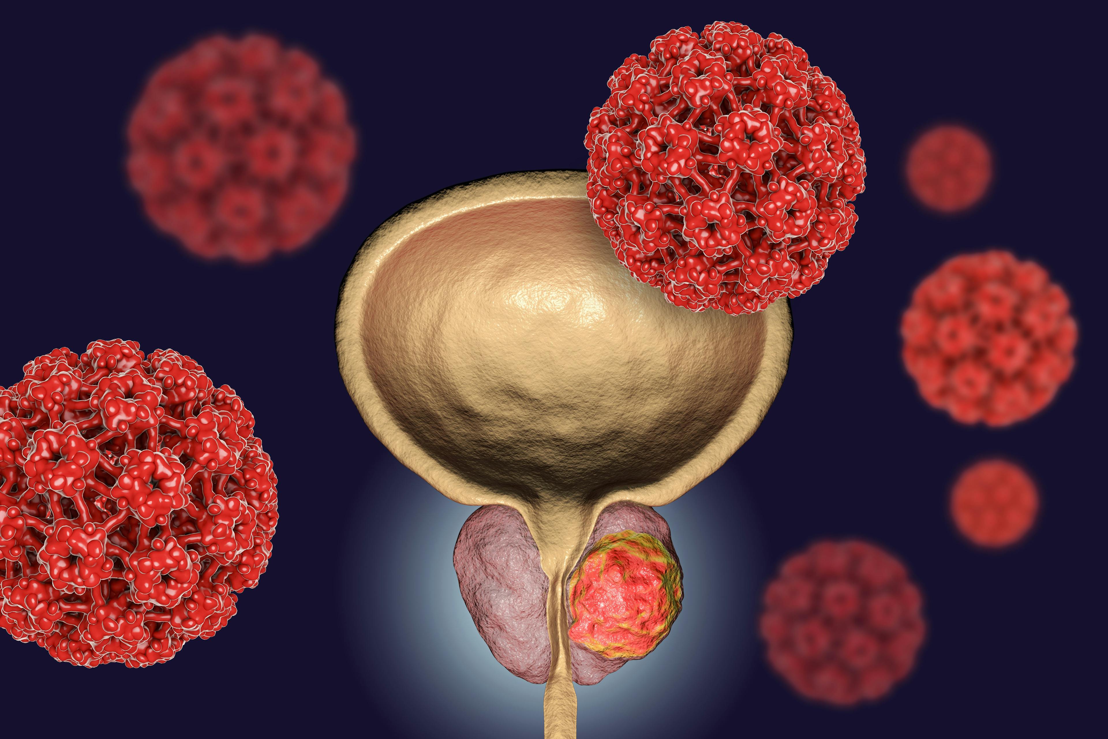 Therapies in the Pipeline for Prostate Cancer