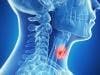 Kinase Inhibitor Favorable for Drug-Resistant Thyroid Cancer