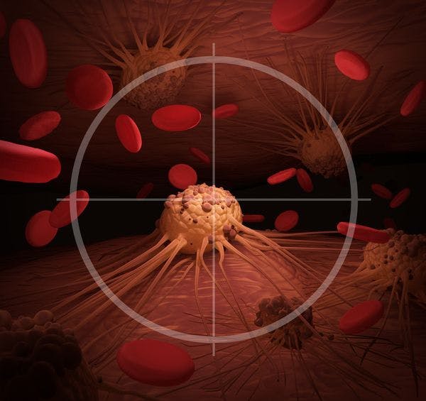 Phase 3 Trial Results Show Metabolic Tumor Volume Improves Prognostication Compared With SPD in Second-Line R/R LBCL