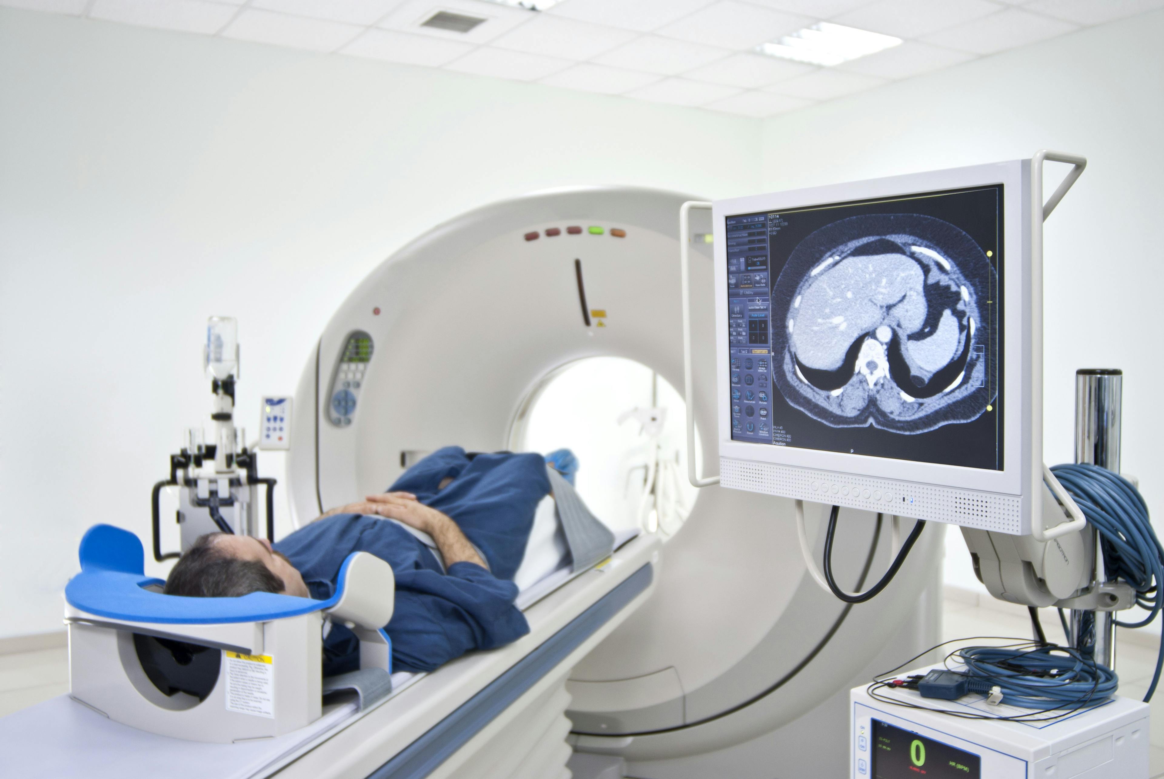 New Imaging Tool Could Improve Precision in Prostate Cancer Diagnoses 