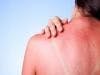 Protecting Against Skin Cancer: FDA Working to Improve Safety of Sunscreen Products