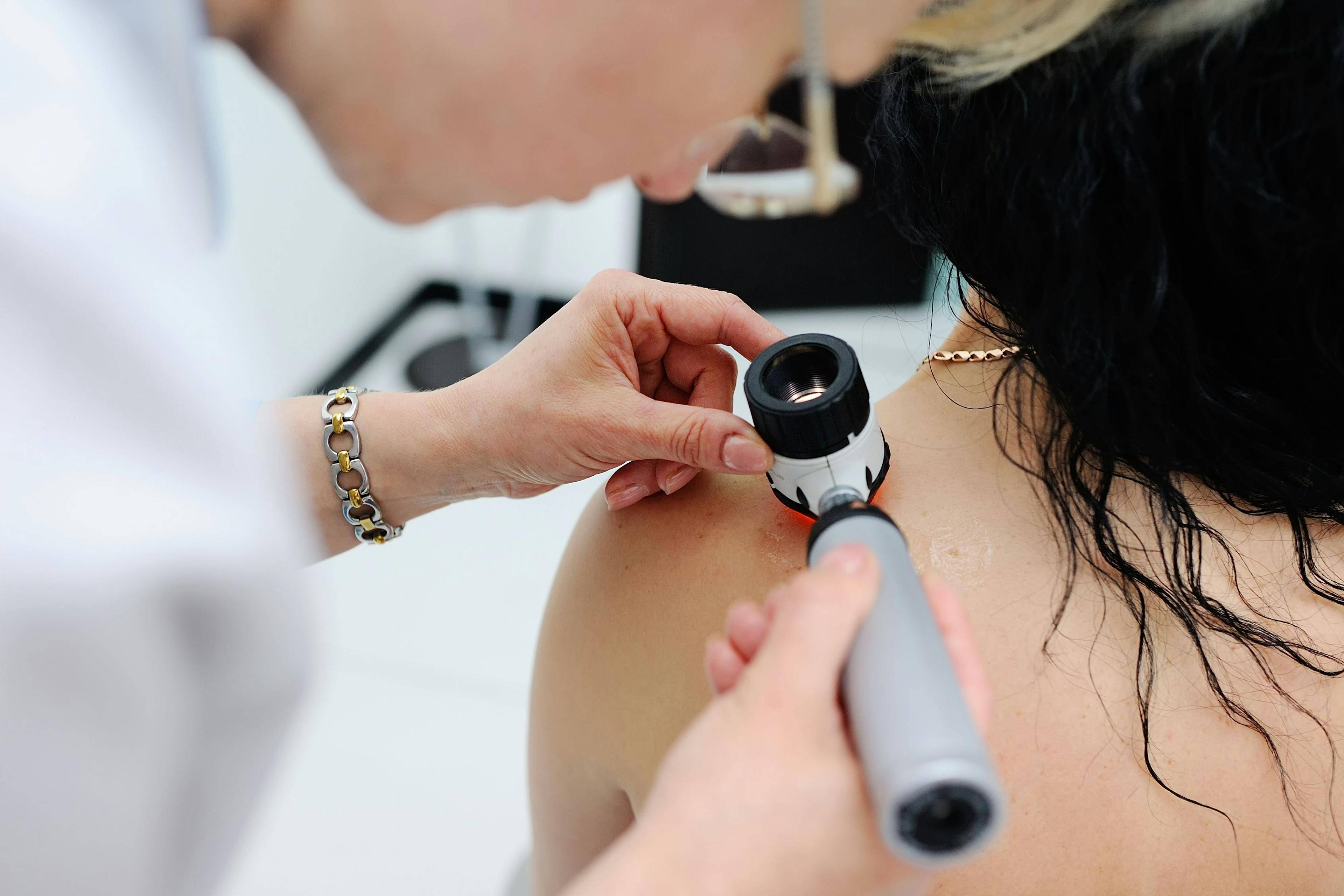 Physician examining melanoma | Image credit: Evgeniy Kalinovskiy - stock.adobe.com