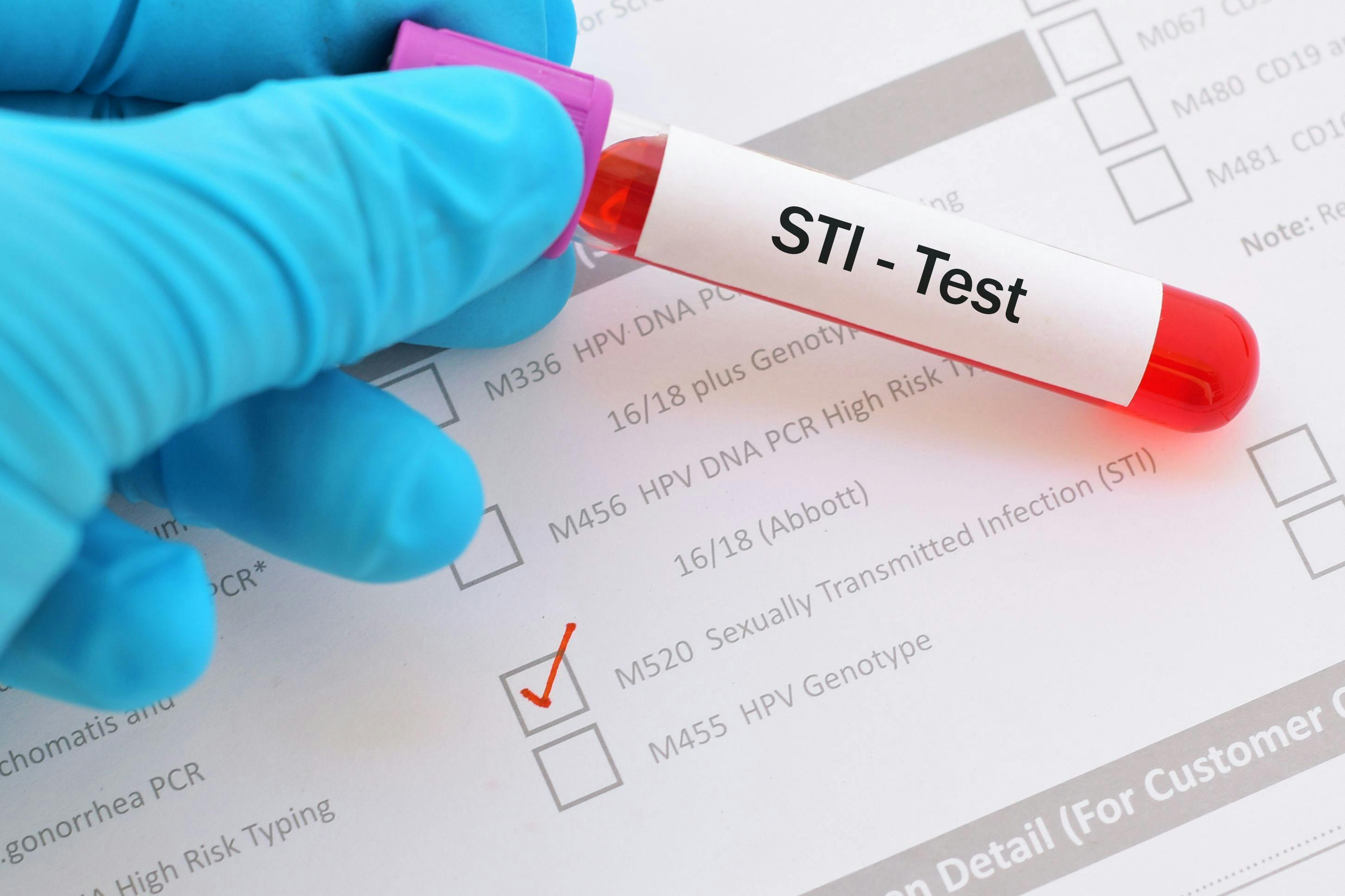 Blood sample with requisition form for sexually transmitted infection (STI) test - Image credit: Jarun011 | stock.adobe.com 