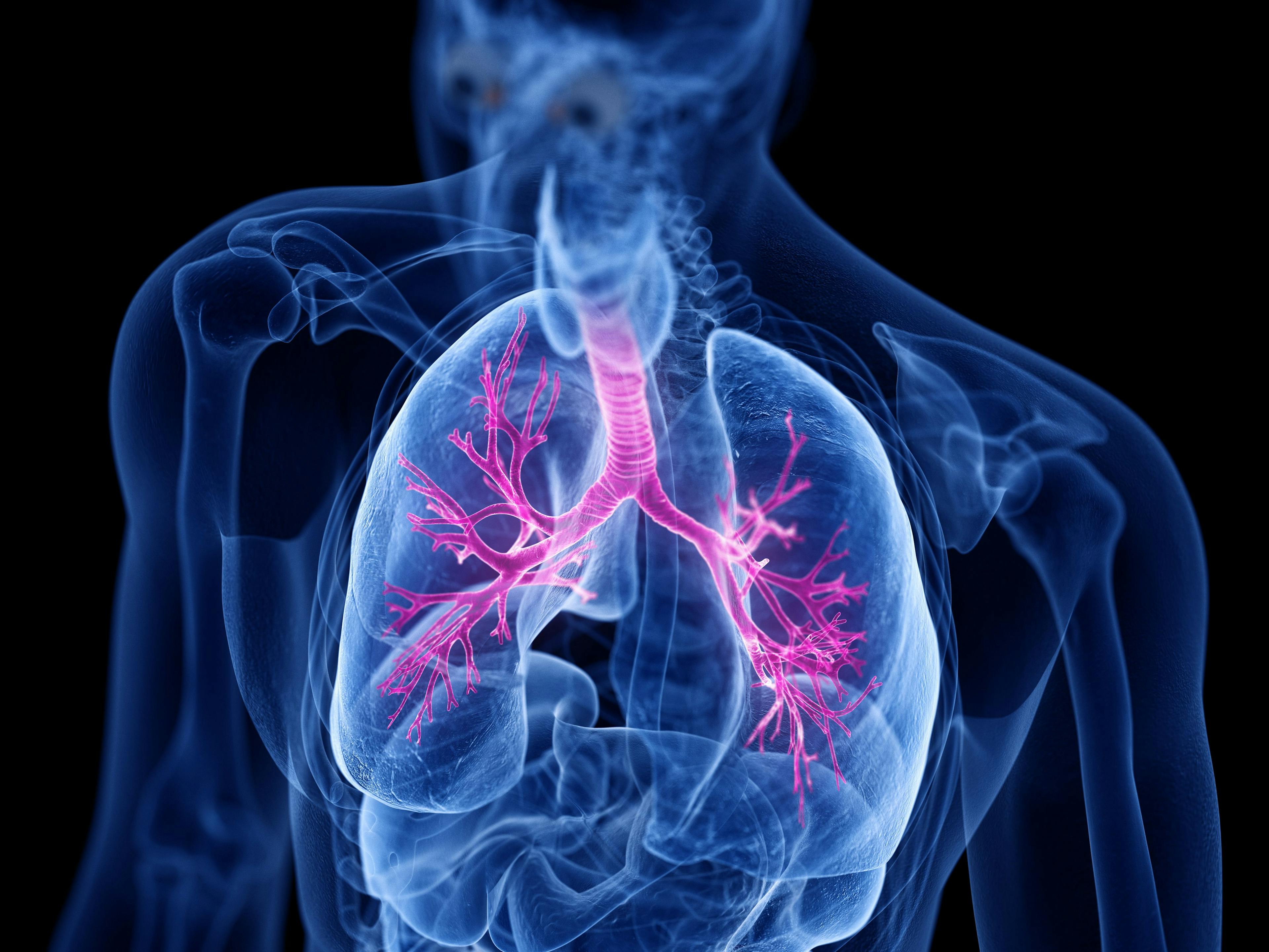 3d rendered medically accurate illustration of the bronchi | Image Credit: Sebastian Kaulitzki - stock.adobe.com
