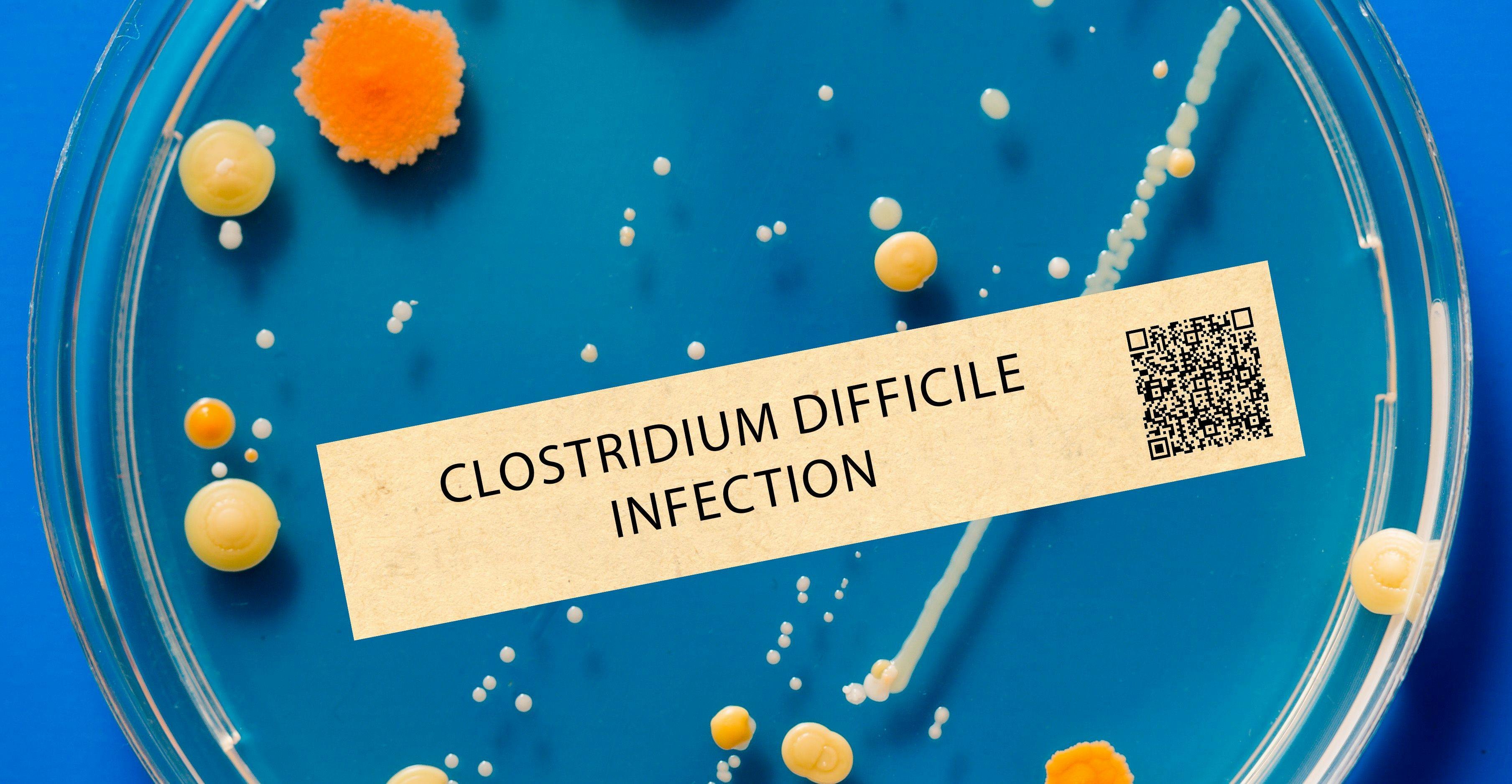 Clostridium difficile infection - Bacterial infection that can cause severe diarrhea and inflammation of the colon. Credit: luchschenF - stock.adobe.com.