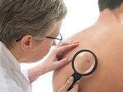 FDA Grants Accelerated Approval to First Treatment for Rare Skin Cancer