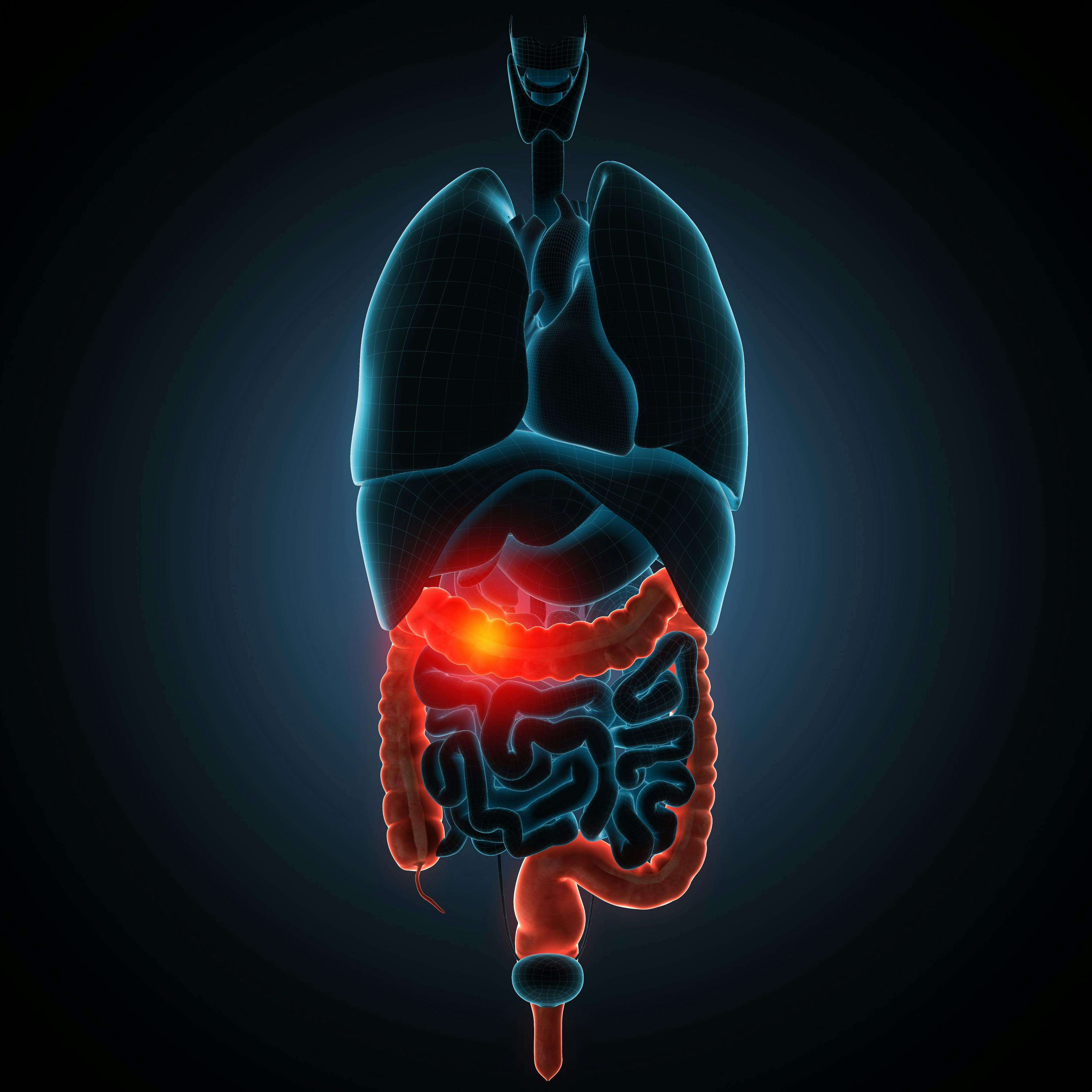 IBD Often Responds to Combination Therapy