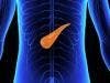 Are Scientists on the Verge of Developing a Blood Test to Detect Pancreatic Cancer Early?