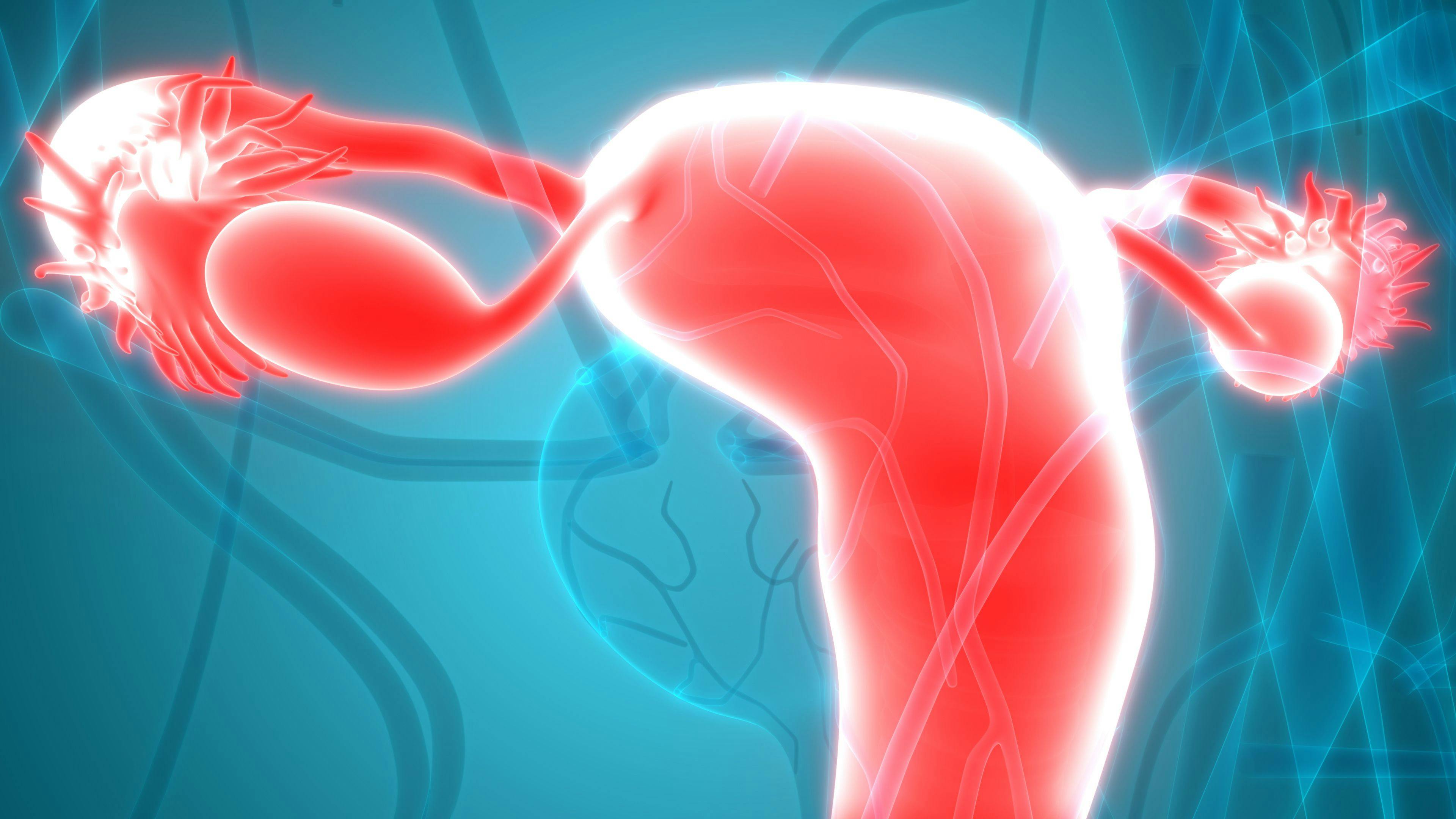 Niraparib as First-Line Maintenance Treatment of Ovarian, Fallopian Tube, Primary Peritoneal Cancer