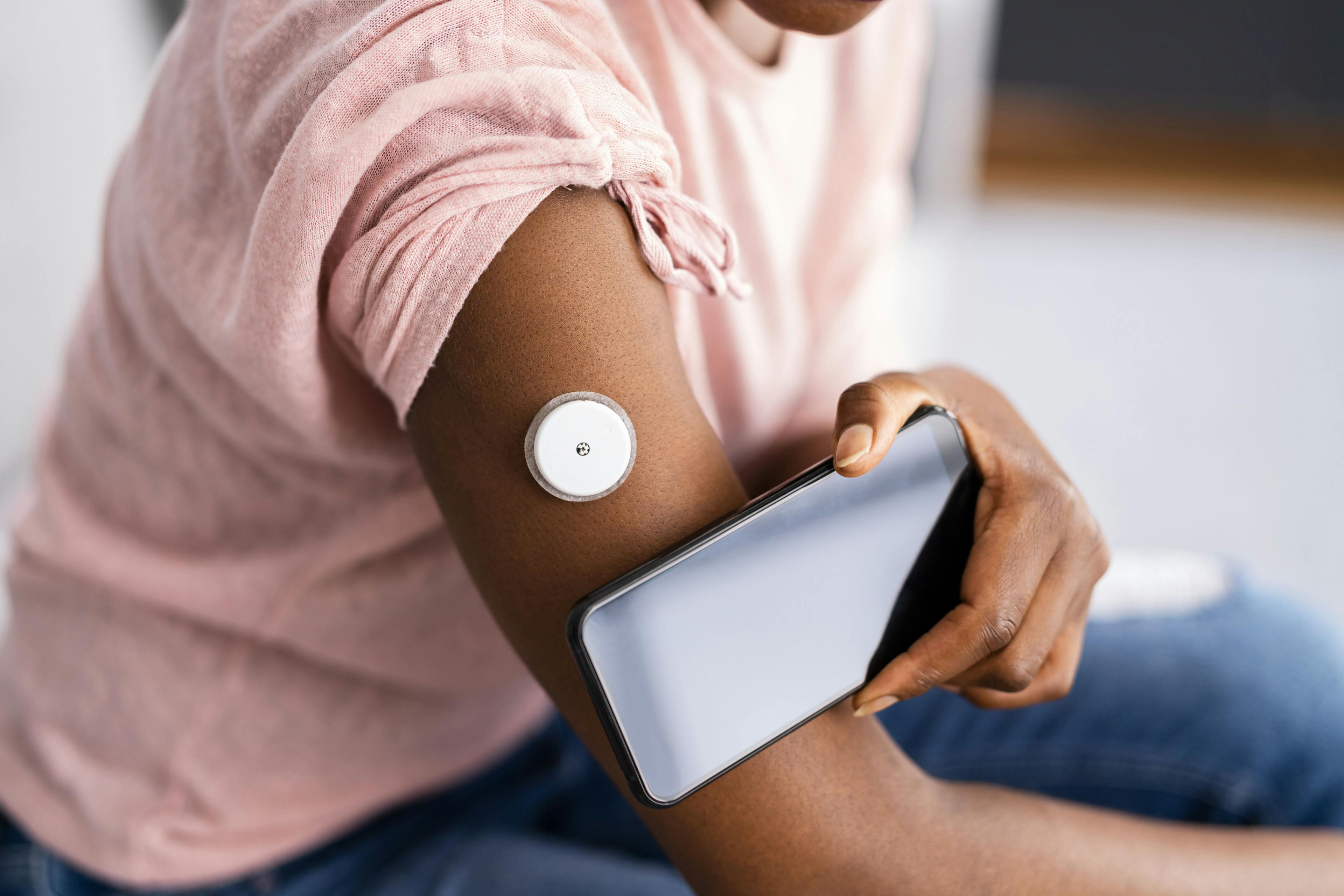 Policy Changes Can Help Implement Continuous Glucose Monitoring