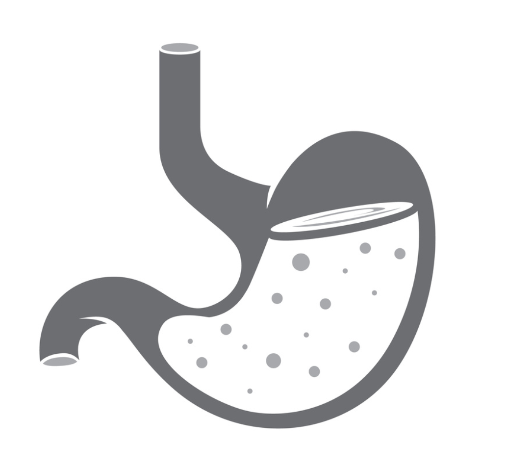 Clinical Pearl of the Day: Gastroparesis