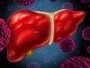 Hepatitis C Antivirals Not Linked to Elevated Liver Cancer Recurrence