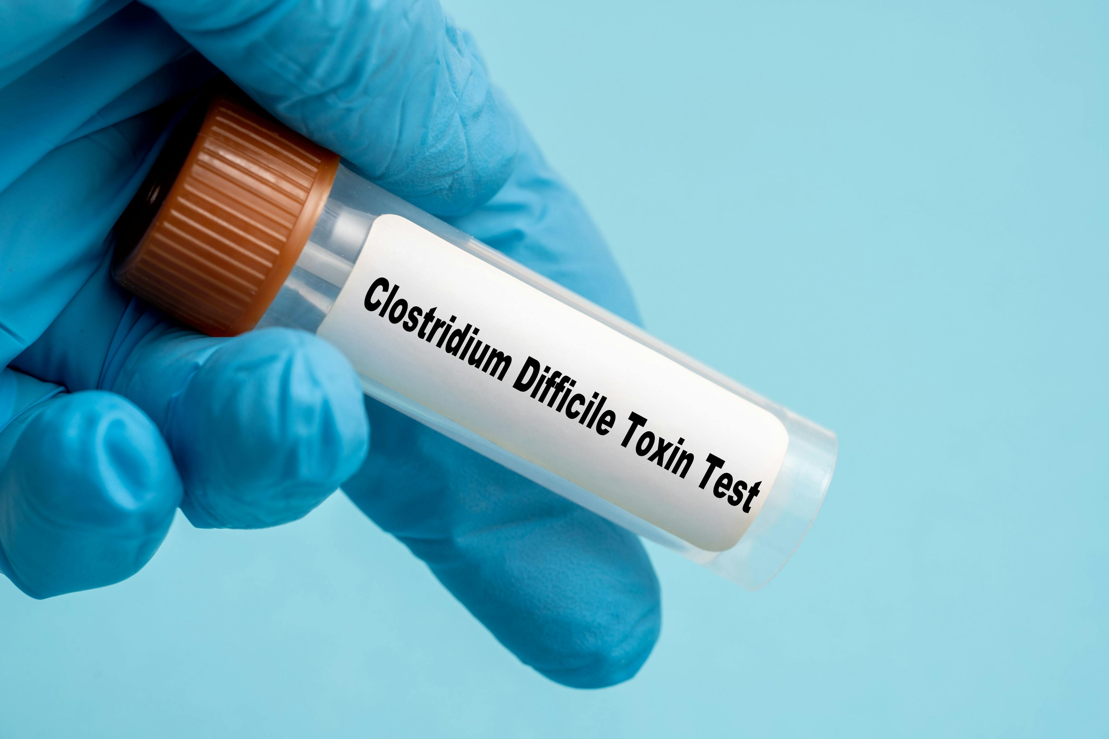 Clostridium Difficile Toxin Test -- Image credit: luchschenF | stock.adobe.com