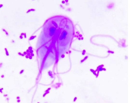 Pharmacy Clinical Pearl of the Day: Giardia Infection