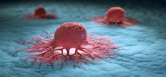 Trial Evaluating Avelumab in Epithelial Ovarian Cancer Fails to Meet Primary Endpoint
