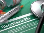 Otezla Elicits Improvements Among Biologic-Naive Patients with Ulcerative Colitis