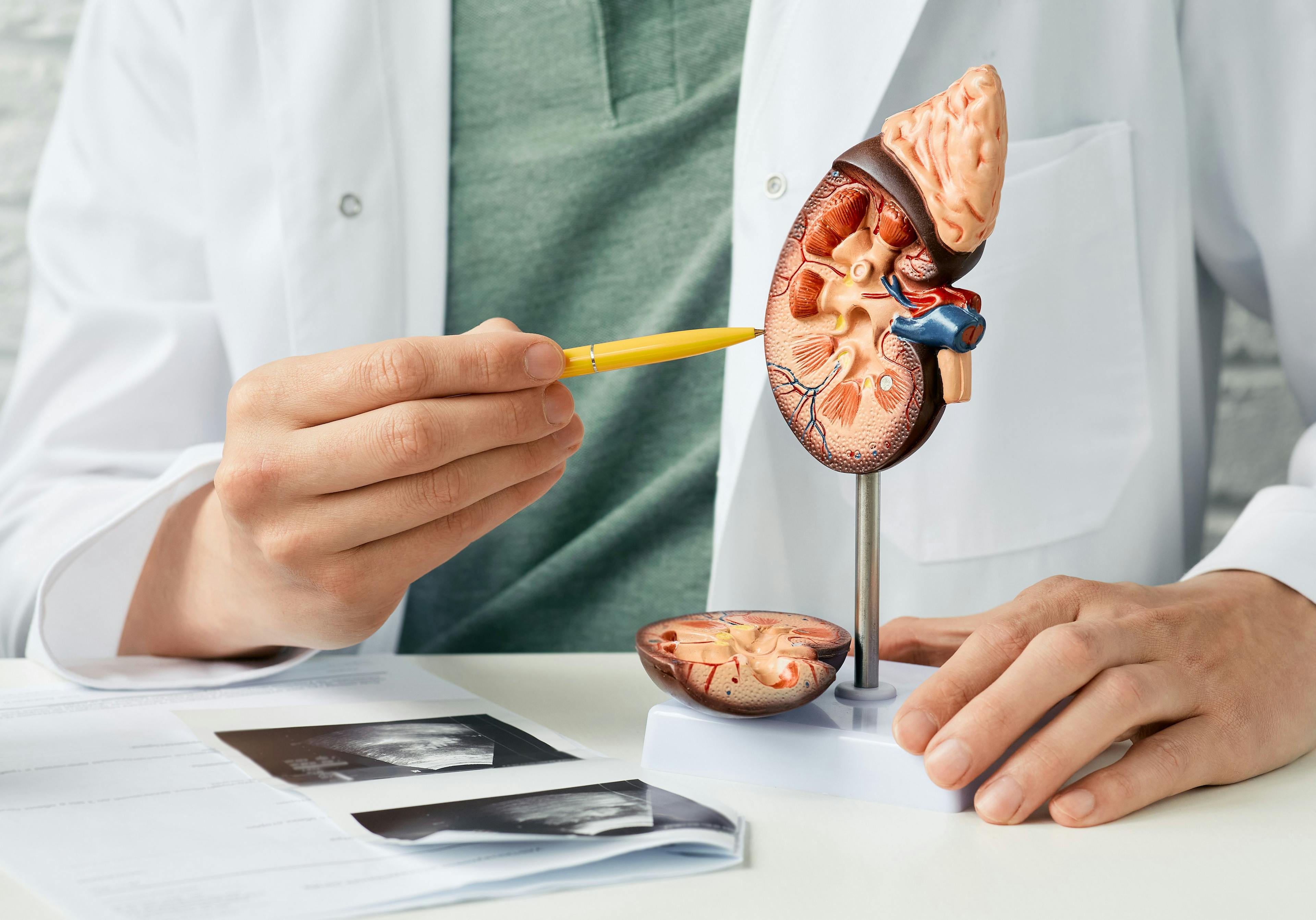 Physician pointing to a kidney model