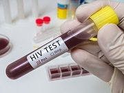 HIV Non-Disclosure Prosecution Fears Lower Testing Rates