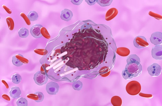 Close up of chronic lymphocytic leukemia -- Image credit: LASZLO | stock.adobe.com