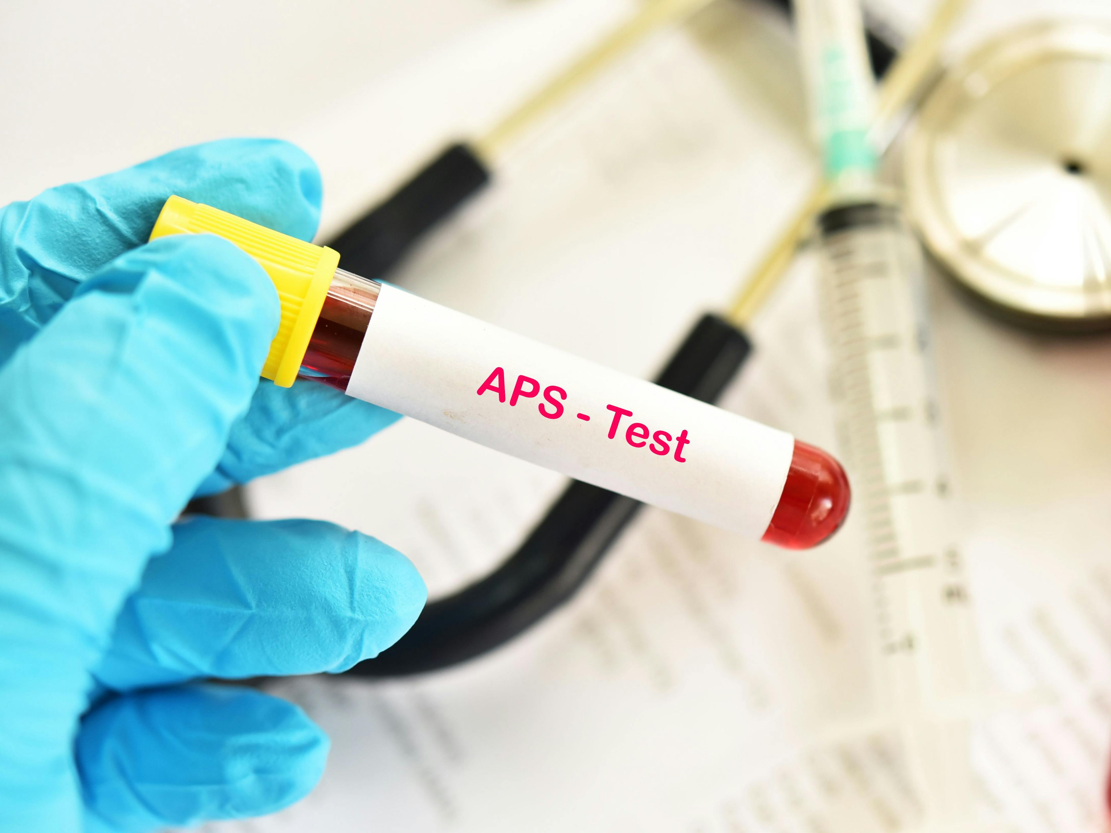 Blood sample tube for antiphospholipid syndrome (APS) test, diagnosis for autoimmune disease - Image credit: Jarun011 | stock.adobe.com 