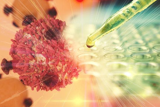 Combating Advancing Cancers With CAR T-Cell Therapy