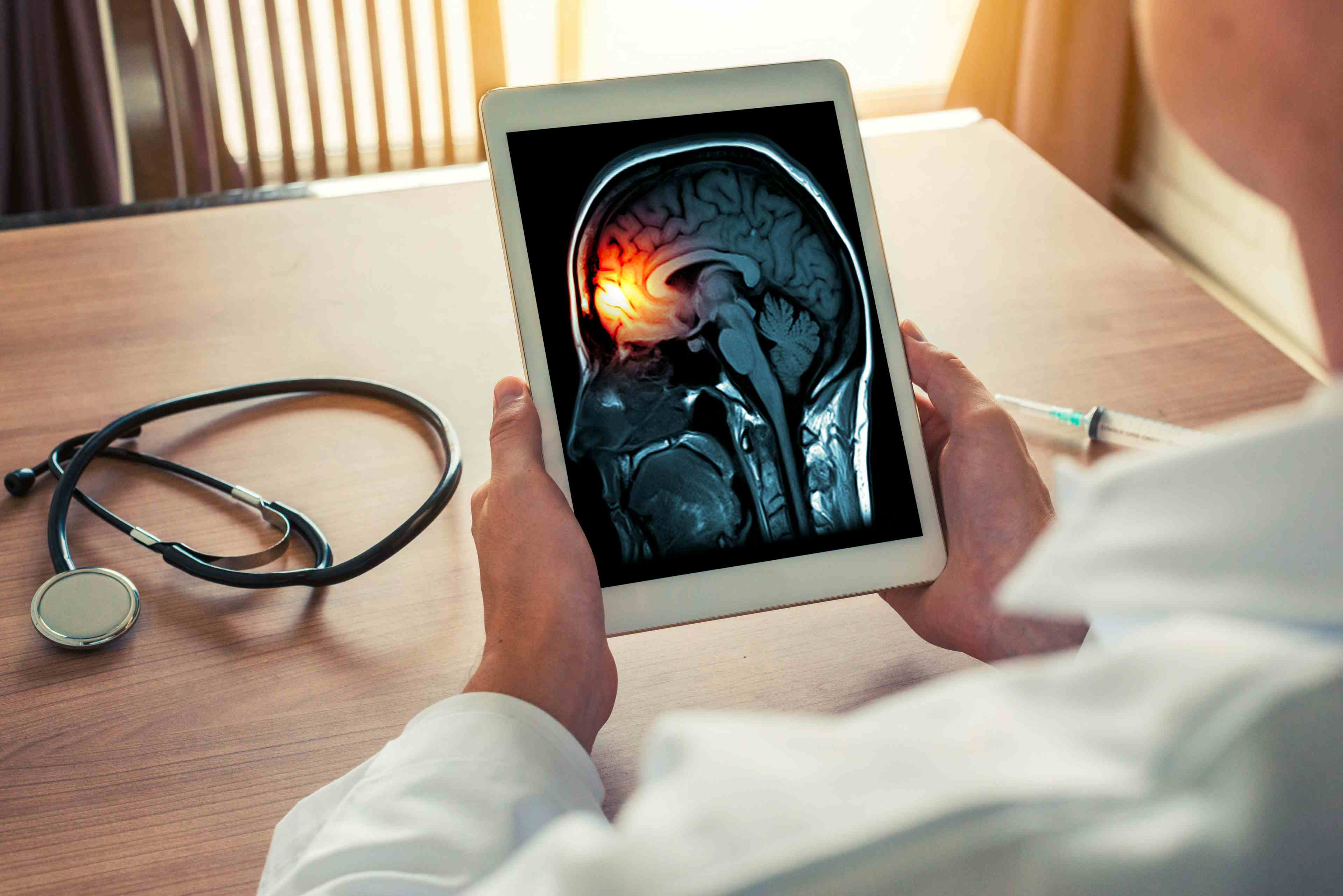 Doctor holding a digital tablet with x-ray of brain and skull skeleton. Headache, meningitis and migraine concept - Image credit: Steph photographies | stock.adobe.com