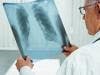 Atezolizumab Found to Reduce Tumor Growth in Lung Cancer Patients