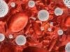 Alprolix Could Be Viable Treatment Option for Hemophilia B Patients