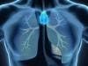 Findings a Less Toxic Radiation Therapy for Lung Cancer